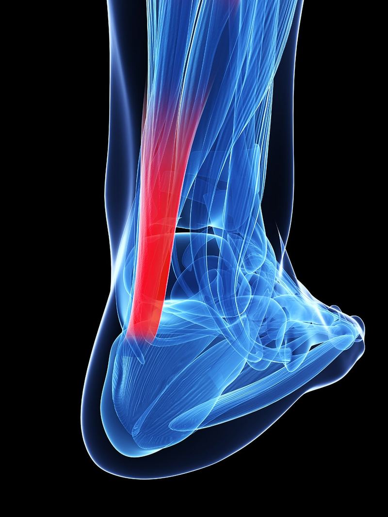 Illustration of the Achilles tendon at the back of the ankle, highlighted in red